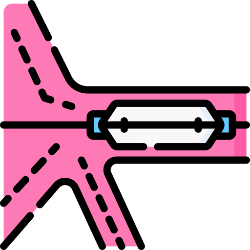 intervencion coronaria percutanea